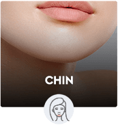 Chin